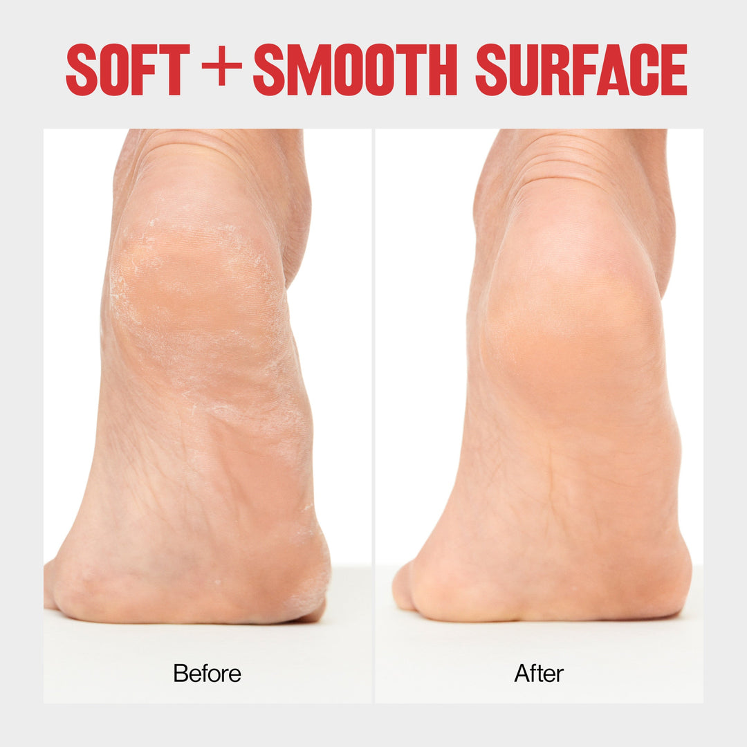 Lime à pieds sur peau sèche/mouillée Revlon®