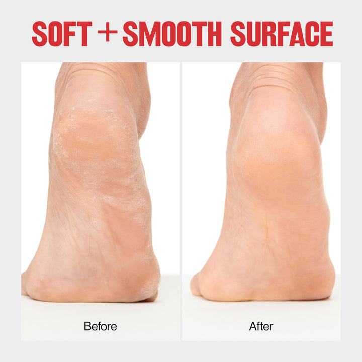 Lime à pieds sur peau sèche/mouillée Revlon®
